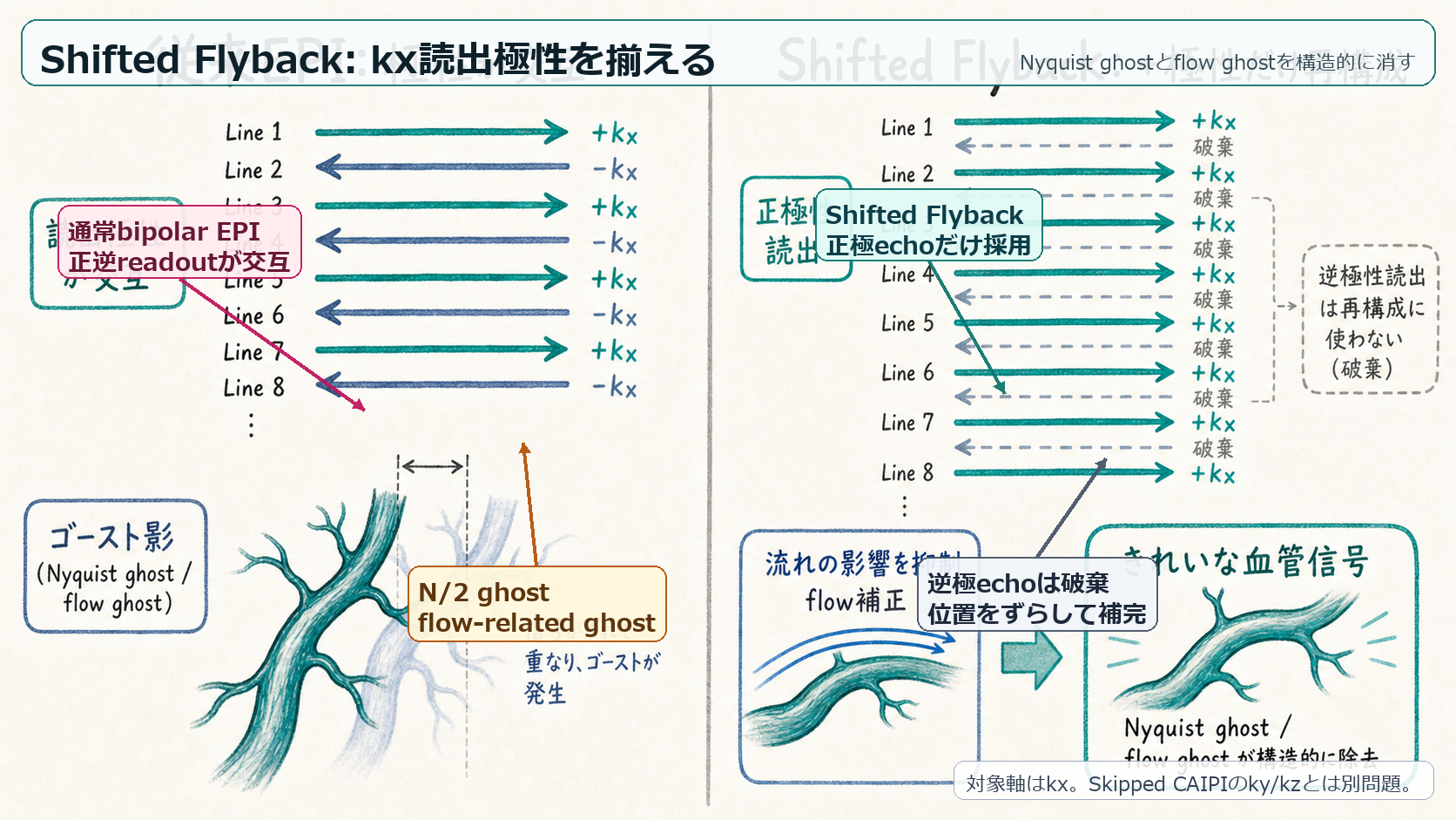 Shifted Flybackのreadout polarity制御